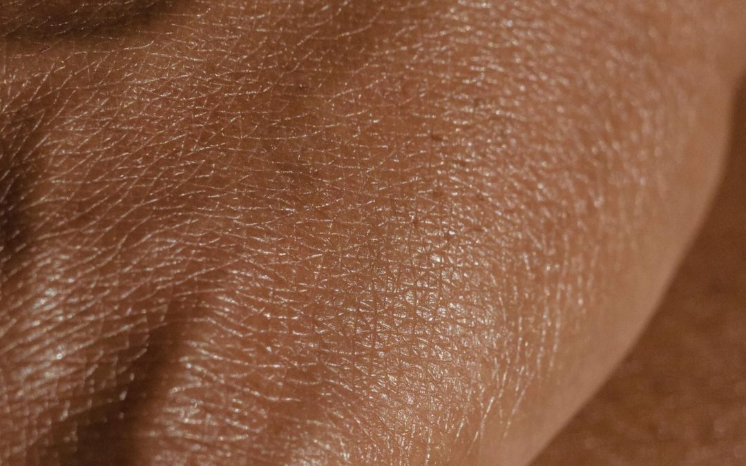 Sind Krampfadern gefährlich? Ein umfassender Leitfaden