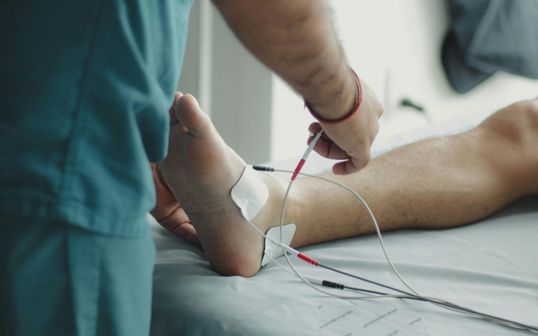 Alles über Venenthrombose: Ursachen, Symptome und Behandlung