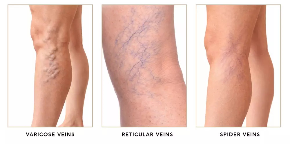 Types of veins