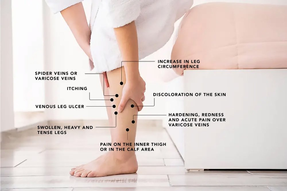 Venous disease check