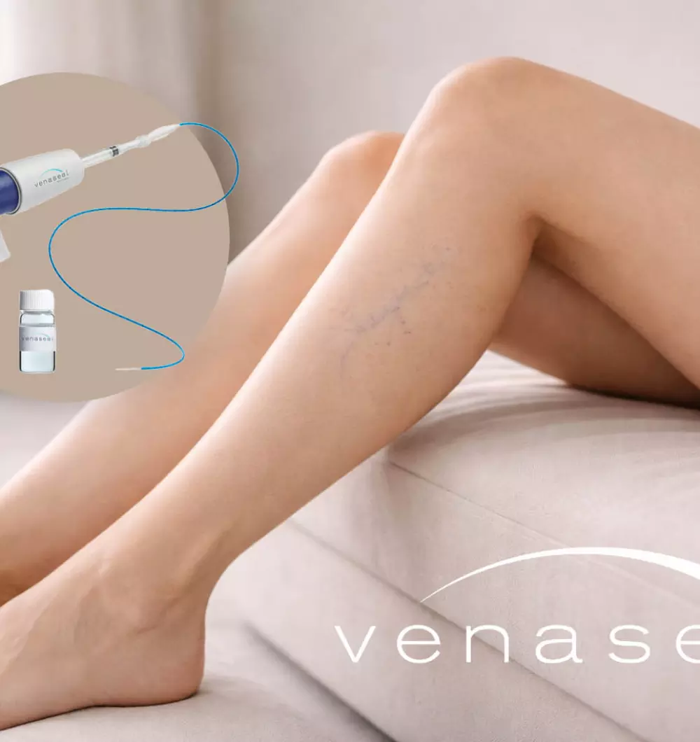 VenaSeal<sup>&reg;</sup>